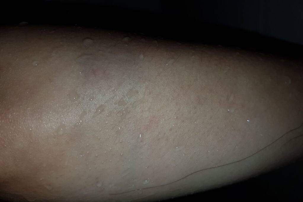 Neergestoken vrouw doet haar verhaal