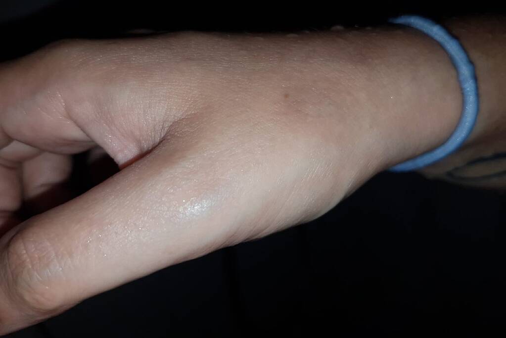 Neergestoken vrouw doet haar verhaal