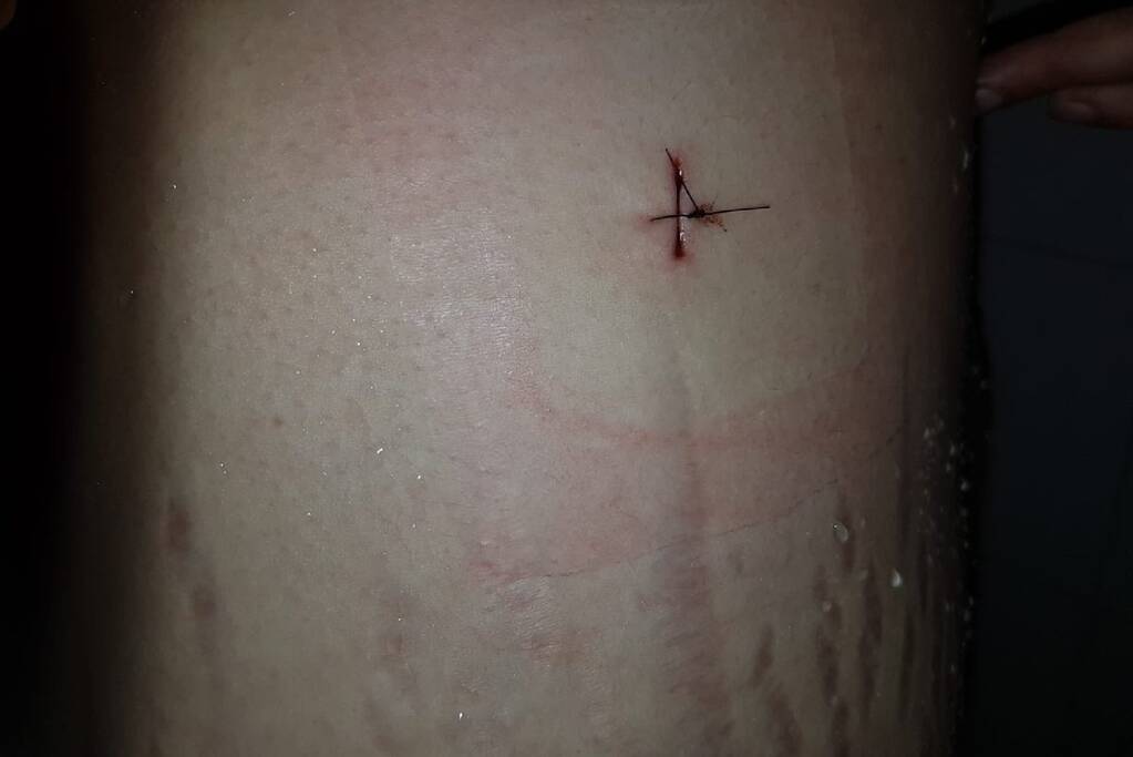 Neergestoken vrouw doet haar verhaal