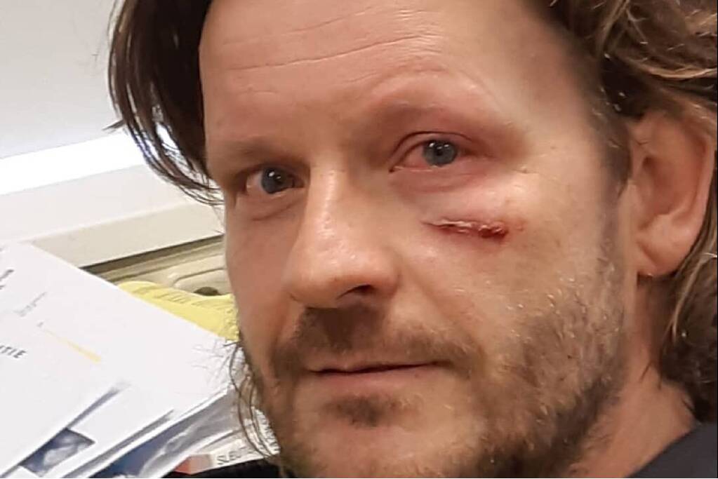 Agressieve man steekt agent met schroevendraaier in gezicht