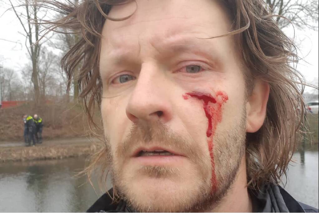 Agressieve man steekt agent met schroevendraaier in gezicht