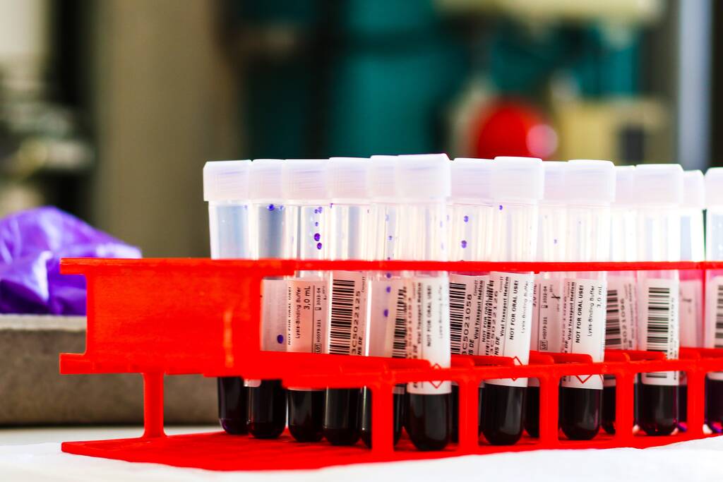 GGD Zuid-Holland Zuid kan nog niet voldoen aan voorrangsregeling testen op corona