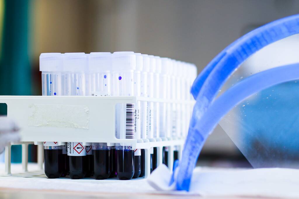 GGD Zuid-Holland Zuid kan nog niet voldoen aan voorrangsregeling testen op corona