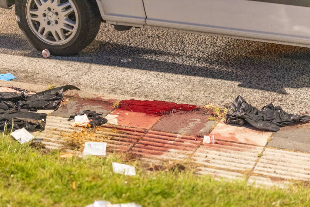 Zwaar gewonde bij steekpartij