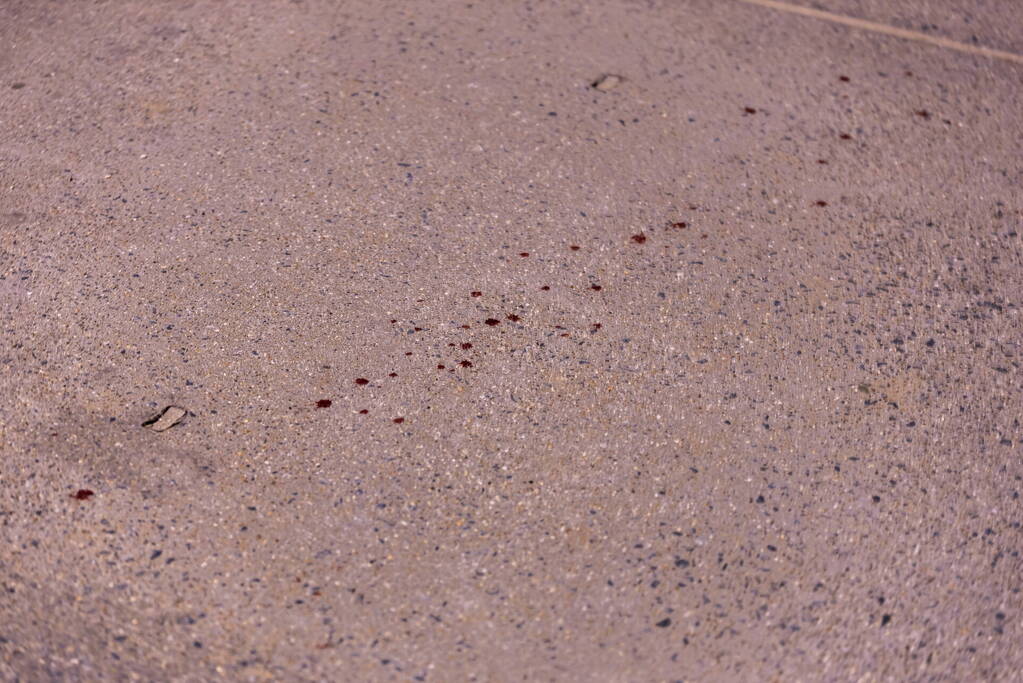 Steekpartij op strand met meerdere gewonden