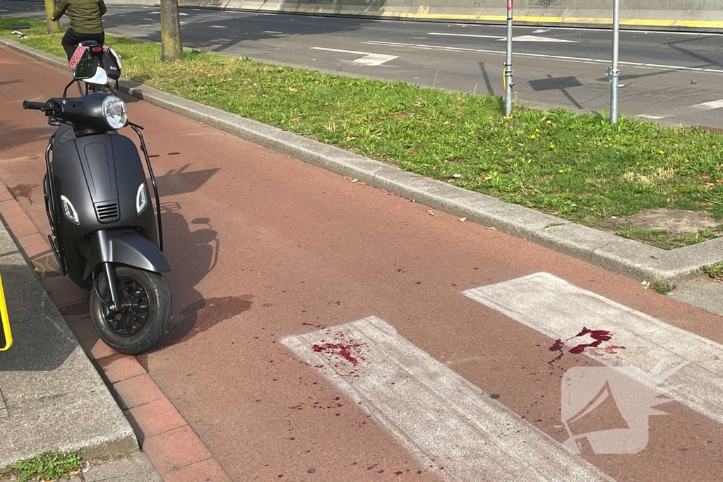 Zwaargewonden na botsing tussen fietser en scooter