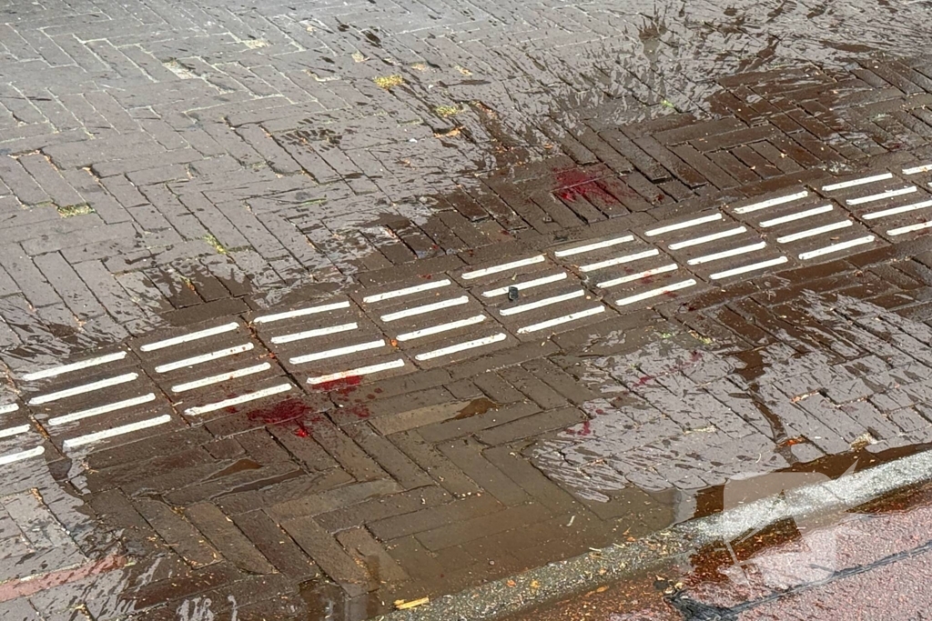 Vrouw (18) in been gestoken door onbekende man