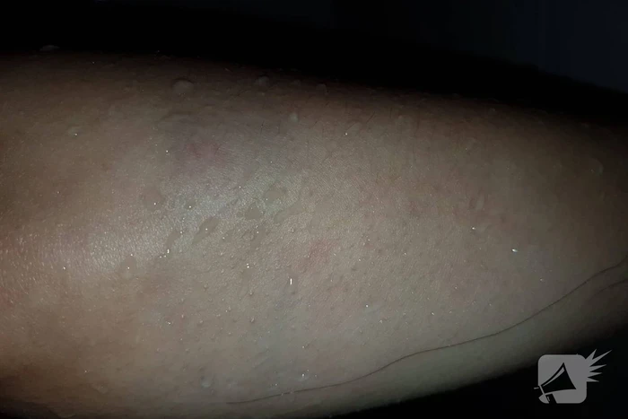 Neergestoken vrouw doet haar verhaal