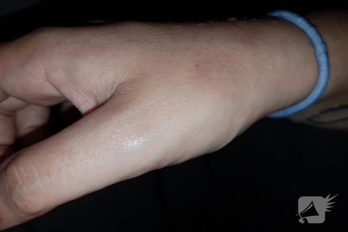 Neergestoken vrouw doet haar verhaal