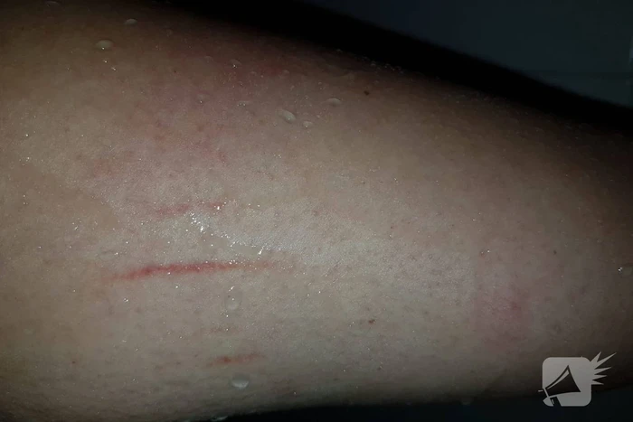 Neergestoken vrouw doet haar verhaal