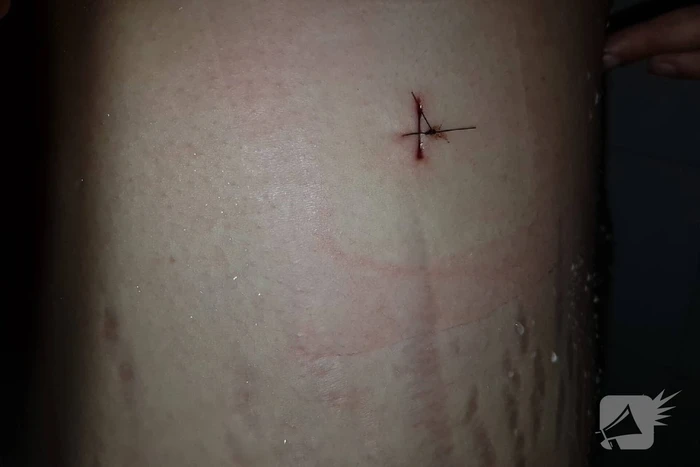 Neergestoken vrouw doet haar verhaal