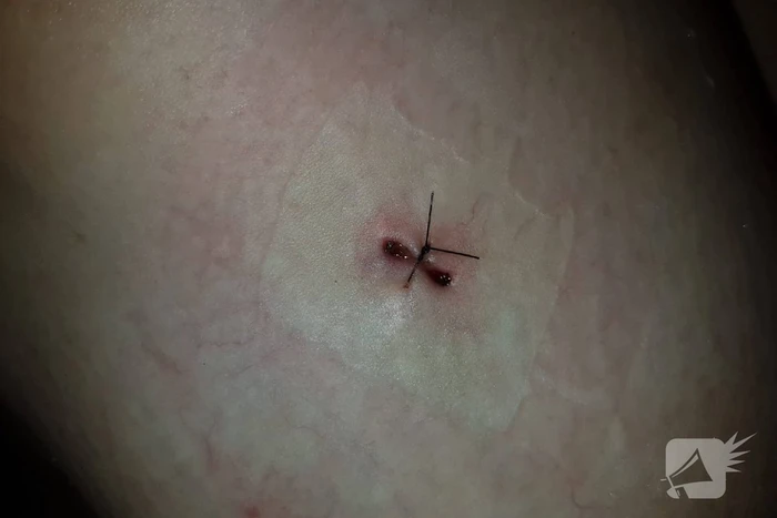 Neergestoken vrouw doet haar verhaal