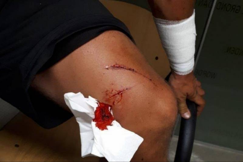 Vier verdachten steekpartij vluchten per auto