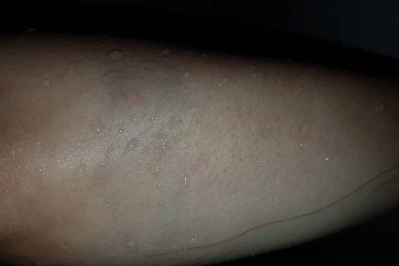 Neergestoken vrouw doet haar verhaal