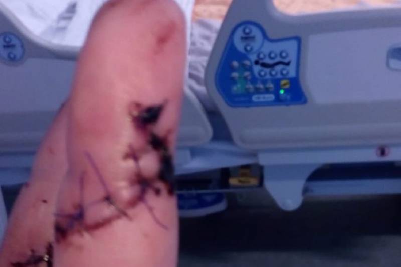 Neergestoken vrouw doet haar verhaal