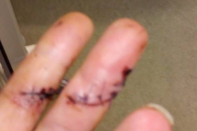 Neergestoken vrouw doet haar verhaal