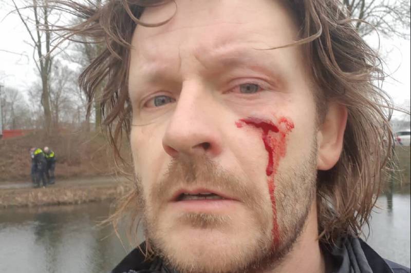 Agressieve man steekt agent met schroevendraaier in gezicht