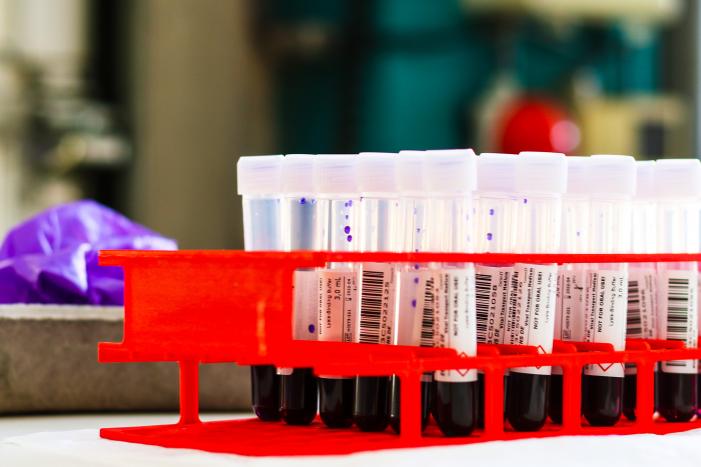 GGD Zuid-Holland Zuid kan nog niet voldoen aan voorrangsregeling testen op corona