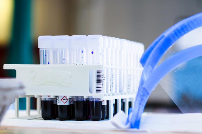 GGD Zuid-Holland Zuid kan nog niet voldoen aan voorrangsregeling testen op corona