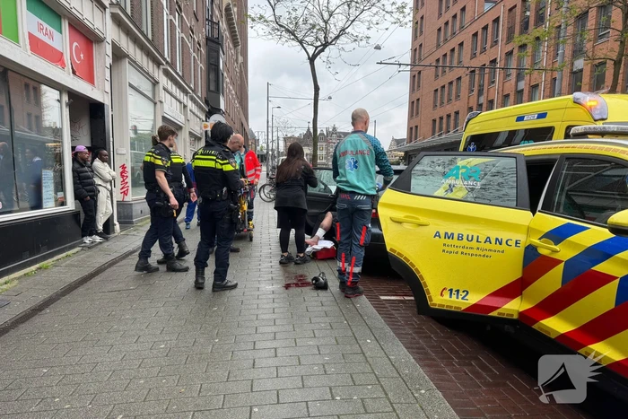 Fietser gewond aan been na aanrijding
