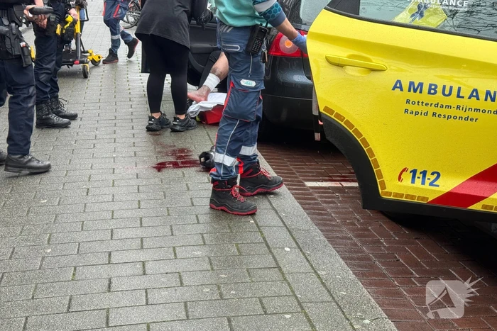 Fietser gewond aan been na aanrijding