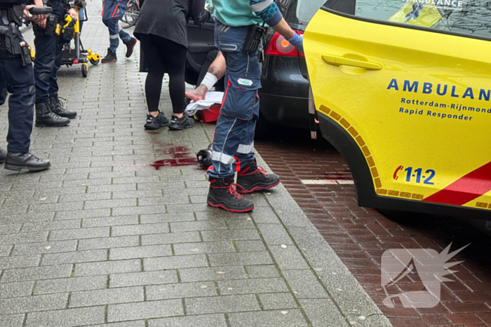 Fietser gewond aan been na aanrijding