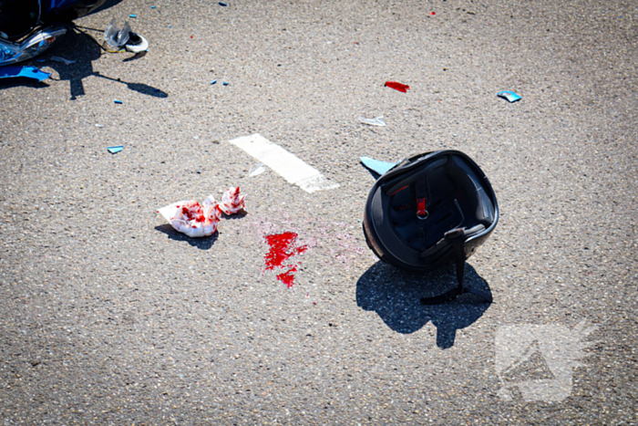 Scooterrijder gewond bij aanrijding met automobilist