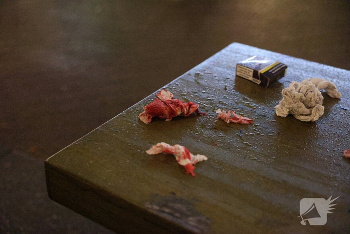 Steekincident bij café leidt tot gewonde